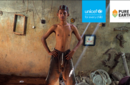 Estudo do Unicef alerta para contaminação de crianças por chumbo 