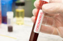 COVID-19: SBP endossa posicionamento da Associação Brasileira de Hematologia, Hemoterapia e Terapia Celular 