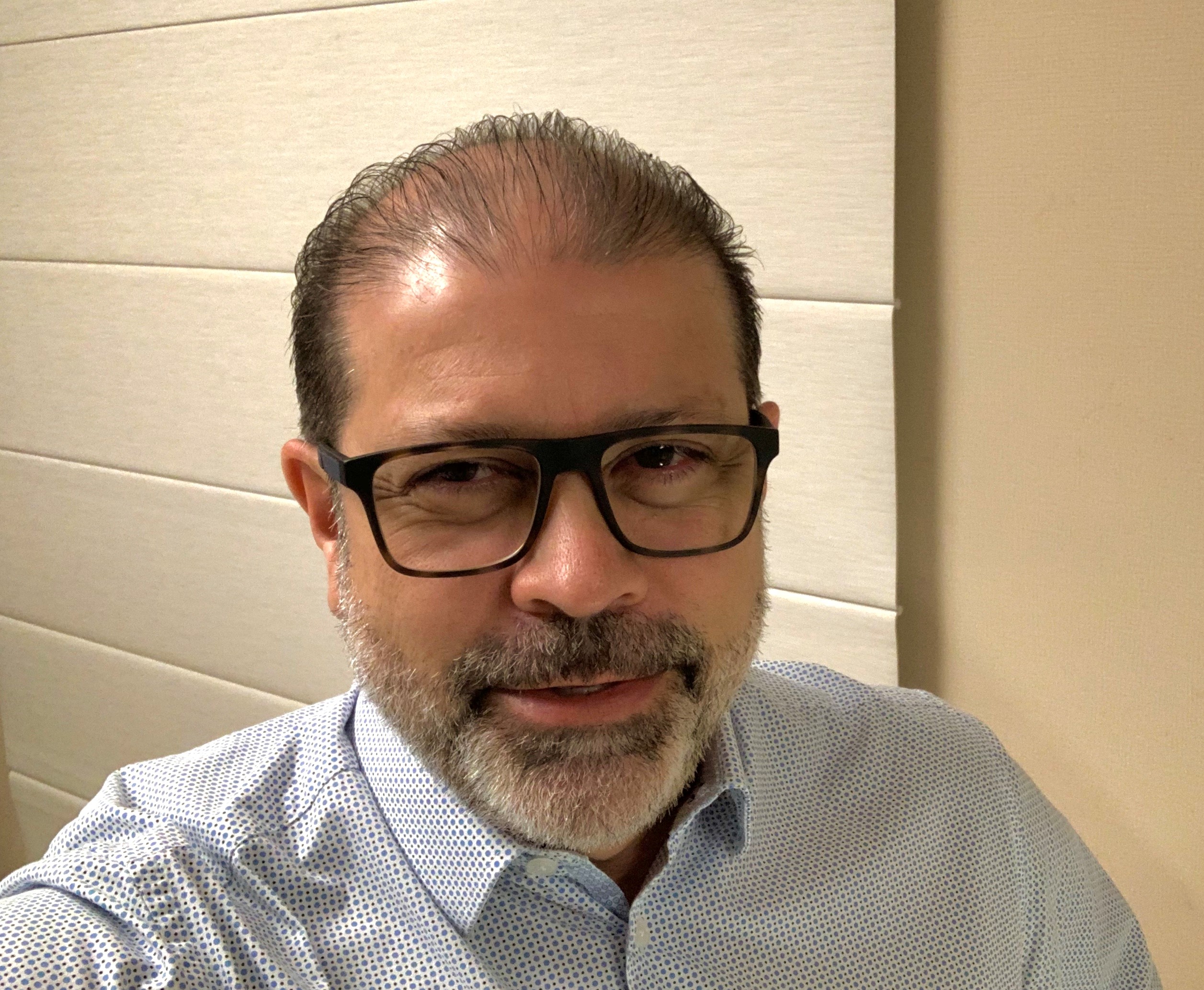 Bruno Acatauassu Paes Barreto